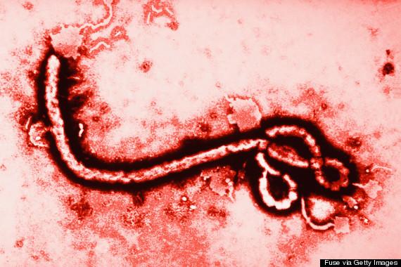 El virus de ébola. 