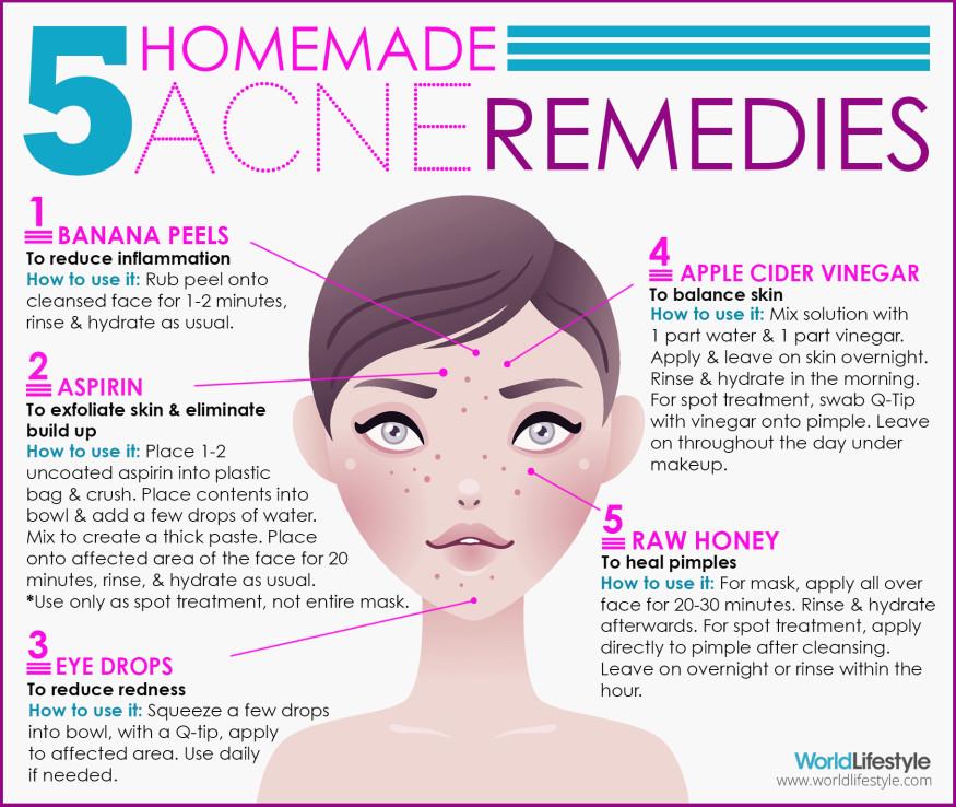 Say Goodbye to Acne the Natural Way â€