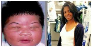 Kamiyah Mobley moments after being born (left), then 18 years later (right). 