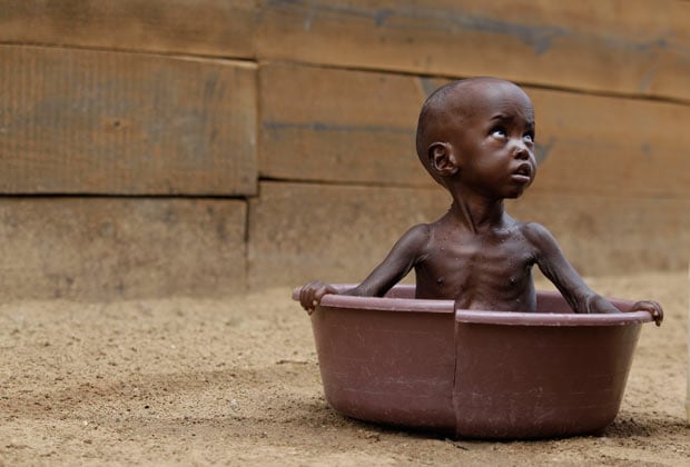 Somalian children face the daily threat of starvation.